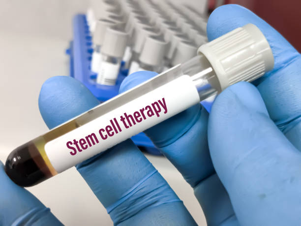 Stem Cell therapy for Cerebral Palsy in India